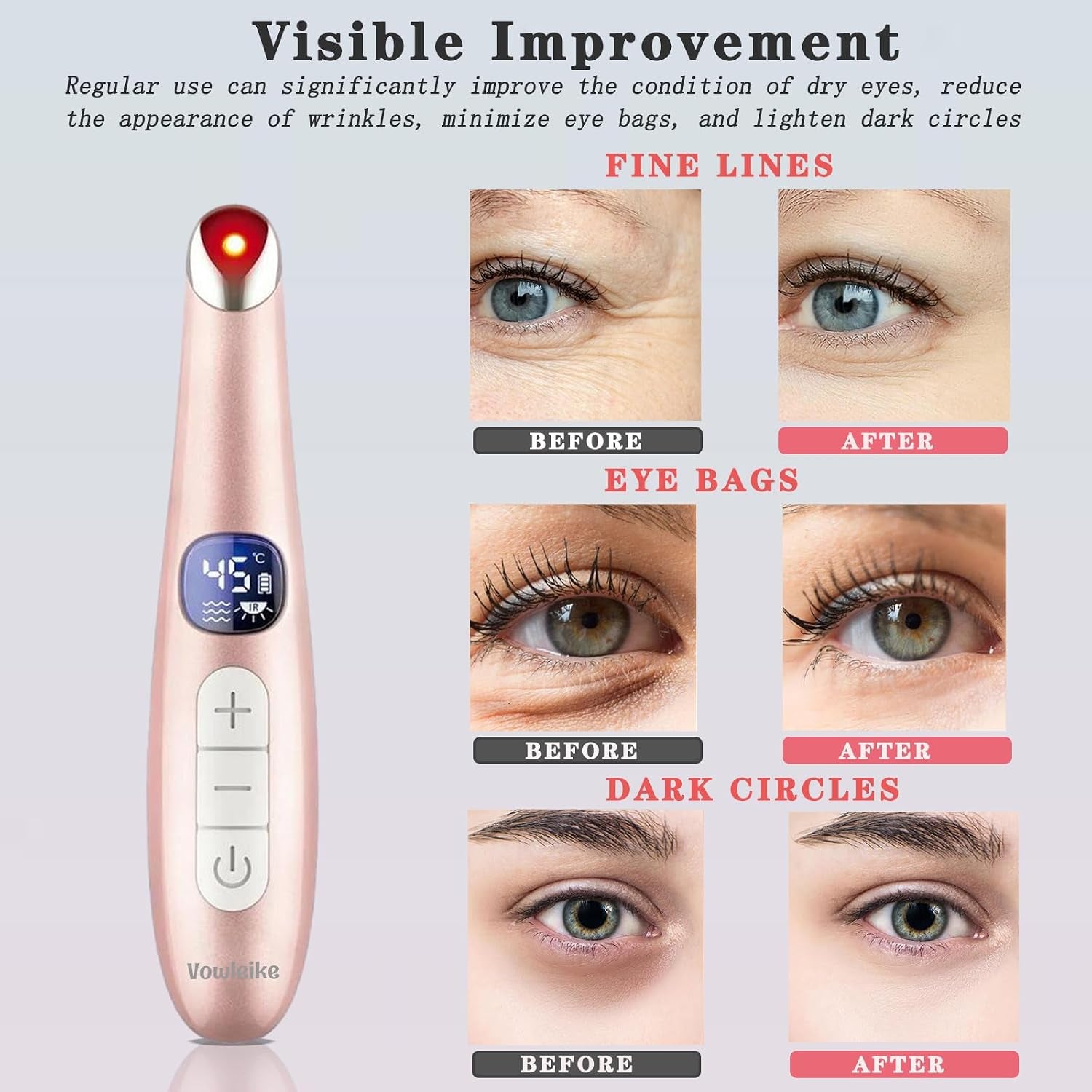 Eye Lift Wand, 3 in 1 Vibrating 98°F to 113°F LCD Eye Massager for Dry Eyes, Dark Circles and Puffiness, Face & Neck Lifting Tool for Fine Lines and Wrinkles, Rose Gold